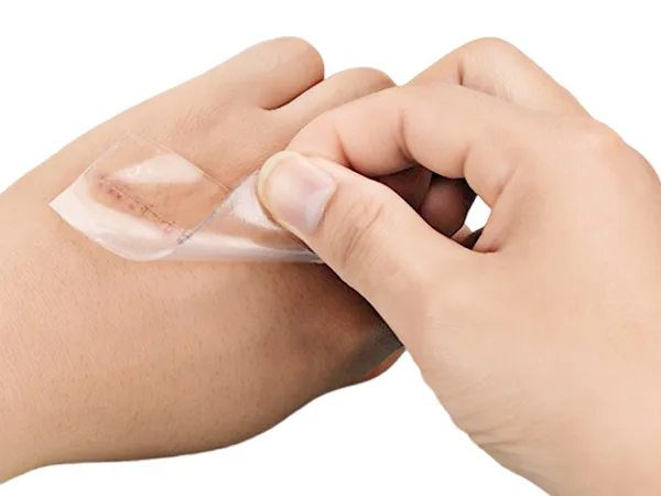 Silicone Gel Scar Sheets